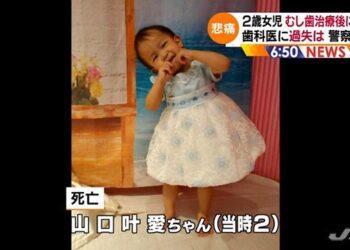 Noa Yamaguchi, de apenas 2 anos, morreu por causa da anestesia do dentista. Foto: JNN.
