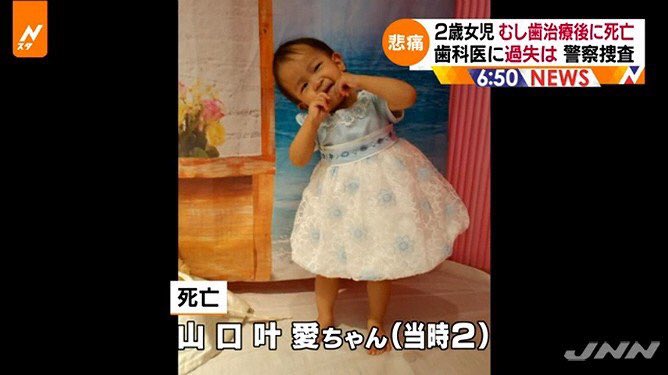 Noa Yamaguchi, de apenas 2 anos, morreu por causa da anestesia do dentista. Foto: JNN.