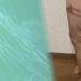 As marcas na perna da menina de 7 anos. Reprodução / FNN