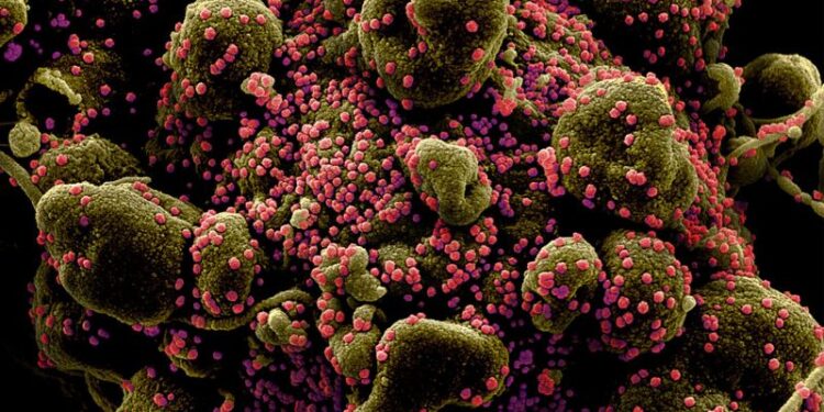 FILE PHOTO: Colorized scanning electron micrograph of an apoptotic cell heavily infected with SARS-COV-2 virus particles, also known as novel coronavirus